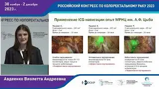 ICG в картировании лимфоузлов при злокачественных новообразованиях правой половины ободочной кишки