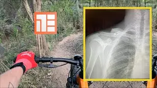 Injury Update | Broken Collarbone 🦴 | Hardtail Mountain Biking Austin TX