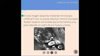 ¿ Qué es la SARNA?