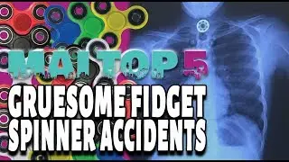 Top 5 Gruesome Fidget Spinner Accidents - Stabbing, Fires and More...