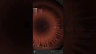 Anime Eyes on Infinite Design