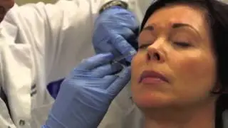 Dr. Freiman Botox Injection
