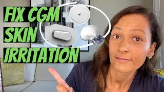 How to prevent skin irritation from CGM adhesive