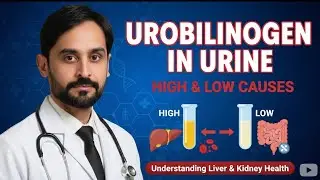 Urobilinogen in Urine | Causes | Reference Range | MLT Hub with kamran