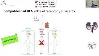 Taller HLA