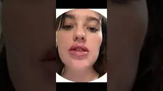 Увеличила губы🫣 #сэрдасэр #юмор #губы