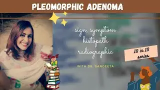 pleomorphic adenoma I oral pathology lectures