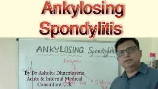 Ankylosing Spondylitis