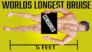 Creating the WORLD'S LONGEST BRUISE Experiment *PURE AGONY*