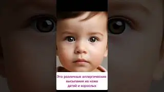 Бесплатный чек-лист получите здесь: https://t.me/+Car105jWIZk3NjEy #грибокногтей #молочница #кандида