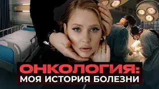 МЕЛАНОМА, ОНКОЛОГИЯ / ПРИЧИНЫ И ПОСЛЕДСТВИЯ / ВРАЧЕБНАЯ ОШИБКА / ВСЕ СТАДИИ ПРИНЯТИЯ БОЛЕЗНИ