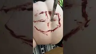 Belly button removal
