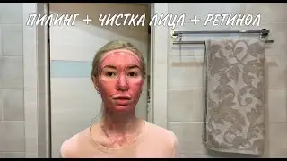 ПИЛИНГ + ЧИСТКА ЛИЦА В ДОМАШНИХ УСЛОВИЯХ