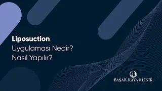 Liposuction Uygulaması Nedir? Nasıl Yapılır?
