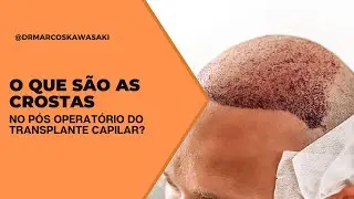 O QUE SÃO AS CROSTAS NO PÓS OPERATÓRIO?