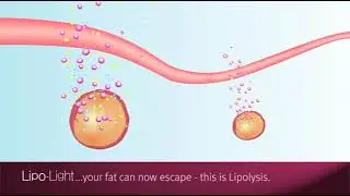Lipo Light