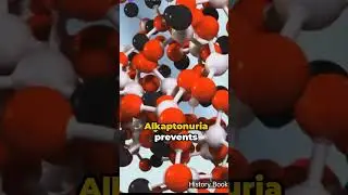 Alkaptonuria, Black urine disease