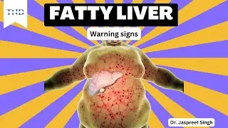 Early Warning Signs of Fatty Liver