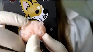ASMR MOST SATISFYING DOCTOR PIMPLE POPPER FOR SLEEP