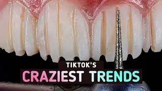 TikTok's Wildest Cosmetic Trends