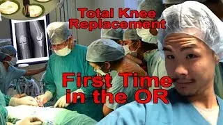 Observing a Total Knee Replacement | Ep. 54 DPT Vlog
