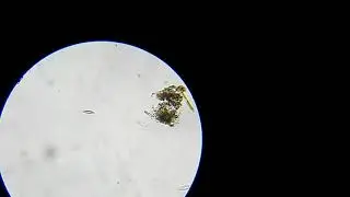 Вода из водоёма под микроскопом