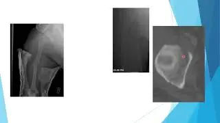 Orthopedic Trauma: Upper extremity 2