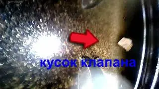 Эндоскопия - Приора кусок клапана