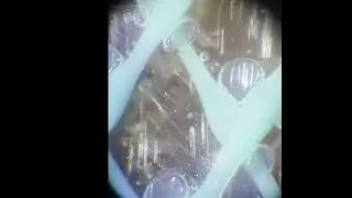 A bubble formation by resin vacuum infusion process