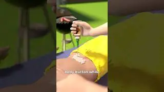 He Superglued His Brothers Belly Button 😳
