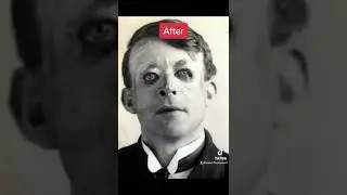 World War Soldiers Before And After 🪖 