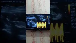 Masyaallah pejuang garis-2 smgt🤰🏼