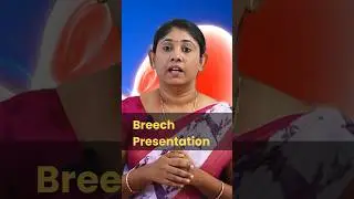 Breech presentation #pregnancytips #normaldelivery #baby #drsavitha #udumalpet