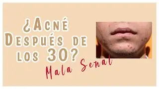 Acné después de los 30, NADA SANO | Los probióticos y sus beneficios | Radio Traspapelados