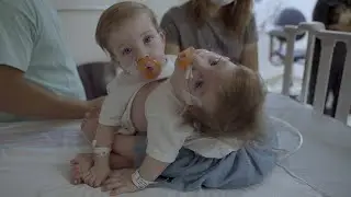 Michigan Medicine Team Separates Conjoined Twins at C.S. Mott Children’s Hospital