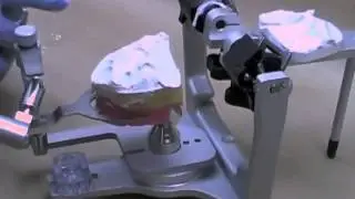 26 Mount Maxillary Cast
