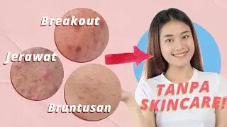 GRATIS ! Ini Cara Menghilangkan Jerawat, Bruntusan, dan Breakout Tanpa Skincare!