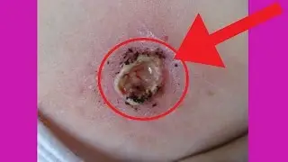 ЧТО БУДЕТ ЕСЛИ СОДРАТЬ РОДИНКУ ?