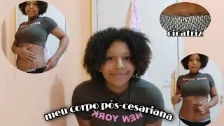 Tuor pelo meu corpo 1 mês pós-parto🥲/a verdade-mãe aos 14