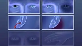 Brain Injuries