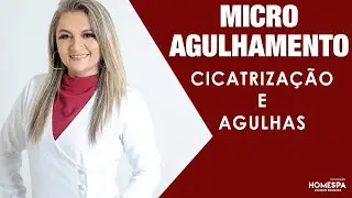MICROAGULHAMENTO: FASES DA CICATRIZAÇÃO E TAMANHO DAS AGULHAS | LOURDES MESQUITA
