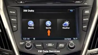 2016 Hyundai Veloster - XMData
