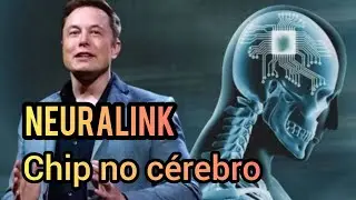 Implante de chip no cérebro humano, o futuro da Neuralink.