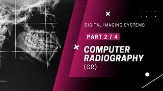 Digital Imaging Systems: Digital Radiography | Chapter 2: Computer Radiography