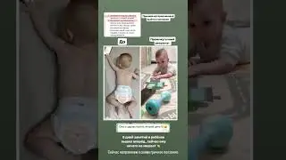 РЕЗУЛЬТАТ ОНЛАЙН КОНСУЛЬТАЦИИ . РЕБЁНОК ЗАСТРЯЛ В САМОЛЁТИКЕ. НАПРАВИЛИ В ПЛАСТУНСКИ #груднички