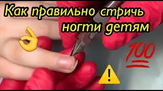Как правильно стричь ногти детям💯👌❗️