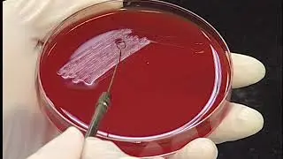 Aseptic Bacterial Culture Technique