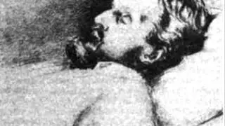 Akce Z - Syfylis