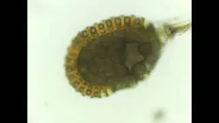 samambaia ao microscópio