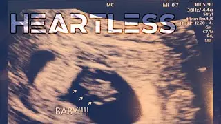 Heartless (prod. ThatKidGoran)